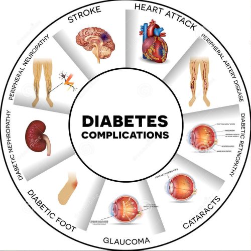 diabetes-complications-affected-organs-affects-nerves-kidneys-eyes-vessels-heart-brain-skin-round-info-graphic-62541059-e1609628312677-1.jpg